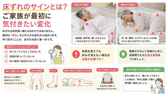 床ずれのサインとは？介護で最初に気付きたい皮膚の赤みと早期対応のポイント